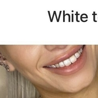 Cassie_rxx Nahé