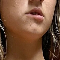 emmaontop Nahé