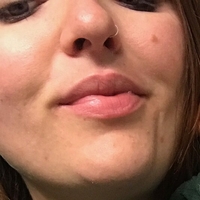 Jessica W Nahé