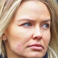 Lara Bingle Nahé
