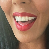 rachelstarrxxx Nahé