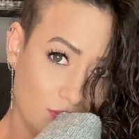 rocking_alopecia Nahé