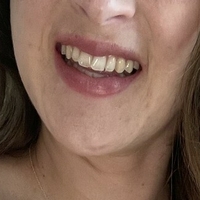 ryleegreenvip Nahé