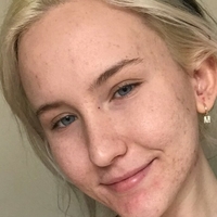Trippi Miki Nahé